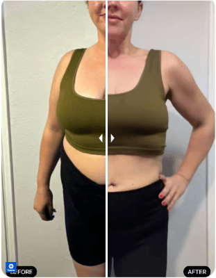 Enhance MD Before After Results