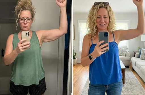 MyoGlow Skin Tightener benefits